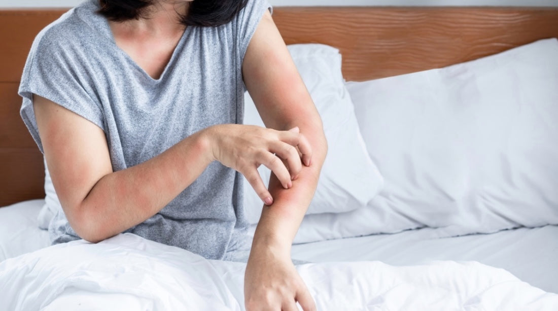 how to stop perimenopause itching