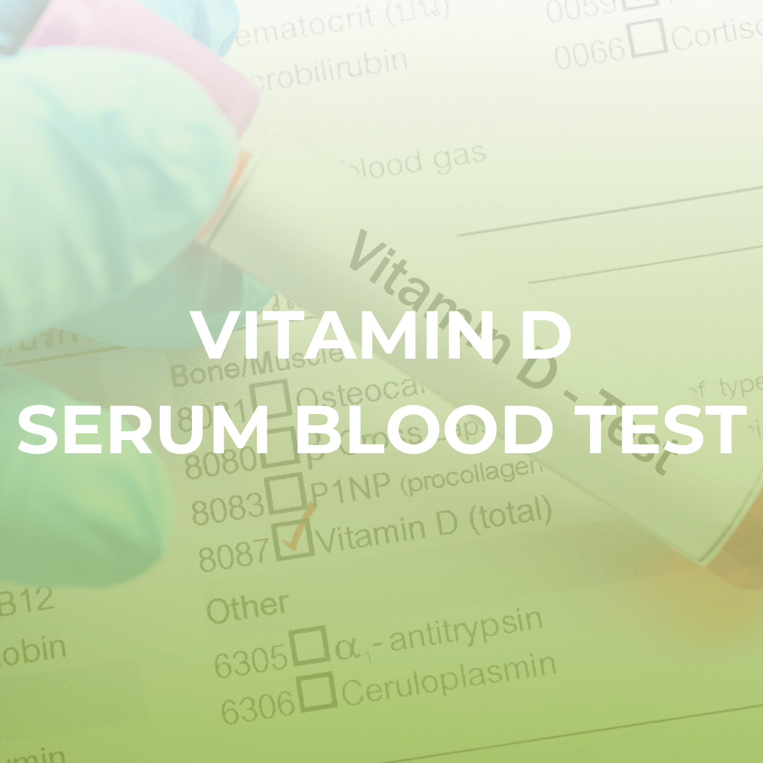 Vitamin D Serum Blood Test